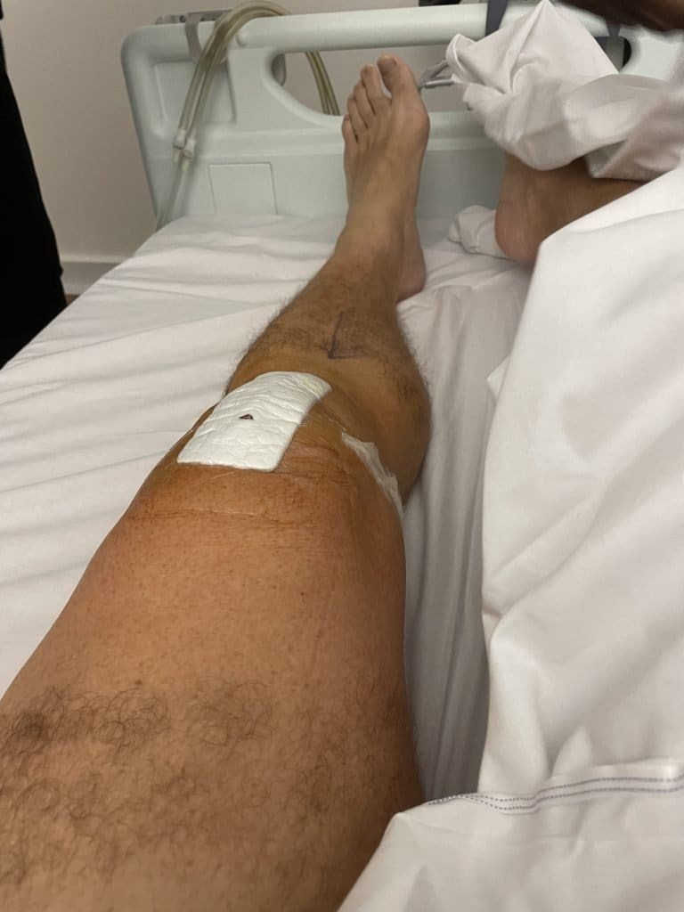 Knee Replacement Surgery